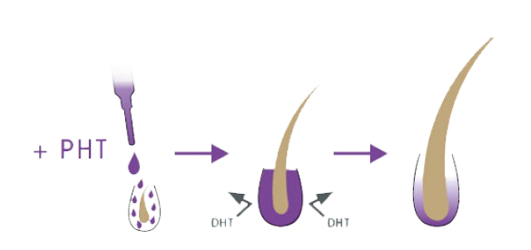 Effect of PHT Complex